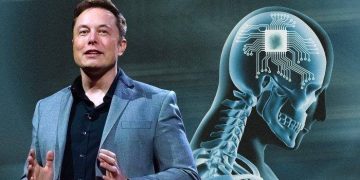 Dekati Barrow Neurological Institute, Perusahaan Elon Musk Akan Tanam Chip ke Otak Manusia