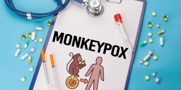 Cara Mencegah Penularan Cacar Monyet