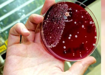 Sebabkan Kematian Usai 48 Jam Terinfeksi, Bakteri Pemakan Daging Gegerkan Jepang