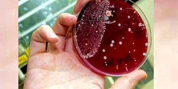 Sebabkan Kematian Usai 48 Jam Terinfeksi, Bakteri Pemakan Daging Gegerkan Jepang