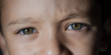 Mengenal Glaukoma Kongenital, Penyakit Mata yang Menyerang Anak-anak