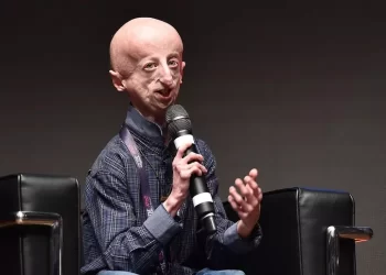 Mengenal Progeria, Penyakit yang Sebabkan Tubuh Menua Sejak Dini