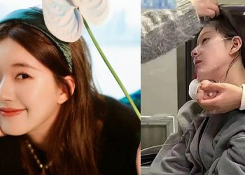 Mengenal Penyakit Afasia; Bikin Penderitanya Sulit Komunikasi