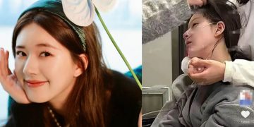 Mengenal Penyakit Afasia; Bikin Penderitanya Sulit Komunikasi